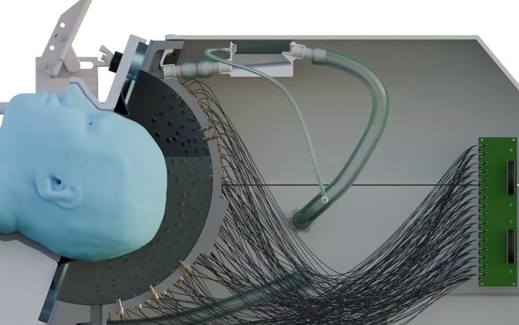 Viitorul terapiilor pentru Parkinson: stimulare cerebrală prin ultrasunete, fără intervenție chirurgicală 1