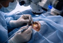 Progres istoric în oftalmologie: vedere redată pacienților condamnați la orbire 9