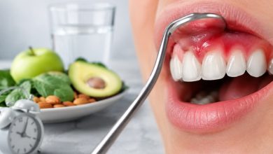 Cercetătorii au descoperit o legătură între post și ameliorarea inflamației gingiilor 2 Cercetătorii au descoperit o legătură între post și ameliorarea inflamației gingiilor 2