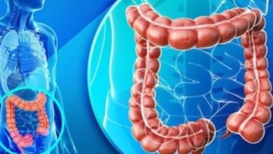 Cancerul colorectal, în creștere alarmantă la adulții tineri: semnele de alarmă pe care medicii spun să nu le ignori 2