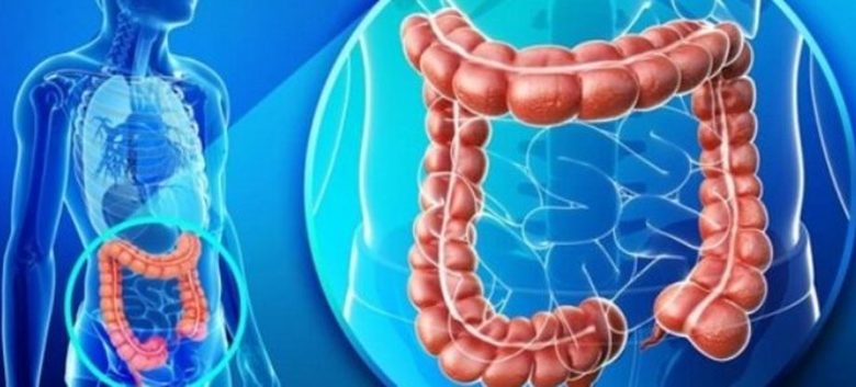 Cancerul colorectal, în creștere alarmantă la adulții tineri: semnele de alarmă pe care medicii spun să nu le ignori 1 Cancerul colorectal, în creștere alarmantă la adulții tineri: semnele de alarmă pe care medicii spun să nu le ignori 1